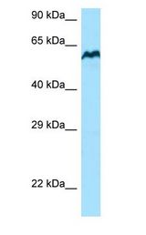 BCMO1 antibody Western Blot of A549 cell lysates. Antibody Dilution: 1.0 ug/ml. BCMO1 is supported by BioGPS gene expression data to be expressed in A549. Antibody dilution: 1 ug/ml.