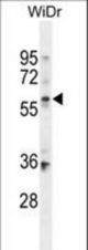 BCMO1 Antibody western blot of WiDr cell line lysates (35 ug/lane). The BCMO1 antibody detected the BCMO1 protein (arrow).