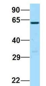 BCMO1 antibody Western Blot of 293T lysate. Antibody Dilution: 1.0 ug/ml. BCMO1 is supported by BioGPS gene expression data to be expressed in HEK293T. Antibody dilution: 1 ug/ml.