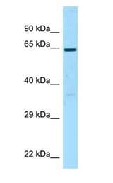 BCMO1 antibody Western Blot of Placenta.