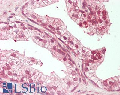 Human Prostate: Formalin-Fixed, Paraffin-Embedded (FFPE)