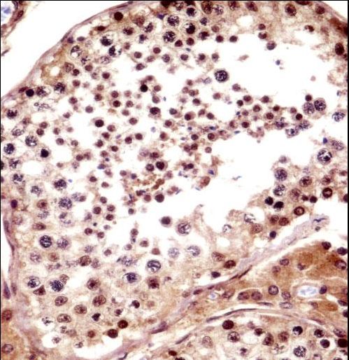 TNKS Antibody immunohistochemistry of formalin-fixed and paraffin-embedded human testis tissue followed by peroxidase-conjugated secondary antibody and DAB staining.
