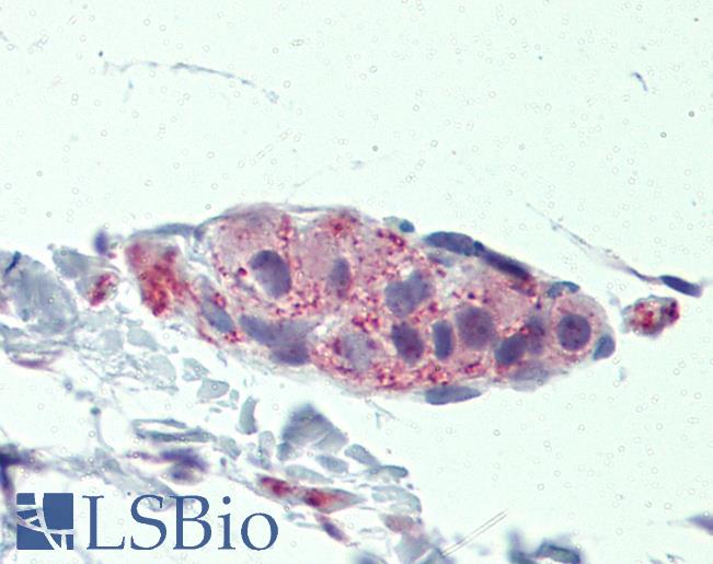 Anti-TNKS / Tankyrase antibody IHC of human small intestine, submucosal plexus. Immunohistochemistry of formalin-fixed, paraffin-embedded tissue after heat-induced antigen retrieval. Antibody LS-B3978 concentration 5 ug/ml.
