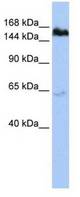 Western blot of HepG2 cell lysate.