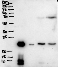 BPIFA1 antibody (2 ug/ml) staining of secretions from Human primary airway cells in culture (lanes 1 and 2), and in Human Bronchoalveolar Lavage fluid (lanes 3 and 4) . Data obtained from Dr. C Bingle, AURM, University of Sheffield, UK. Primary incubation was 1 hour. Detected by chemiluminescence.