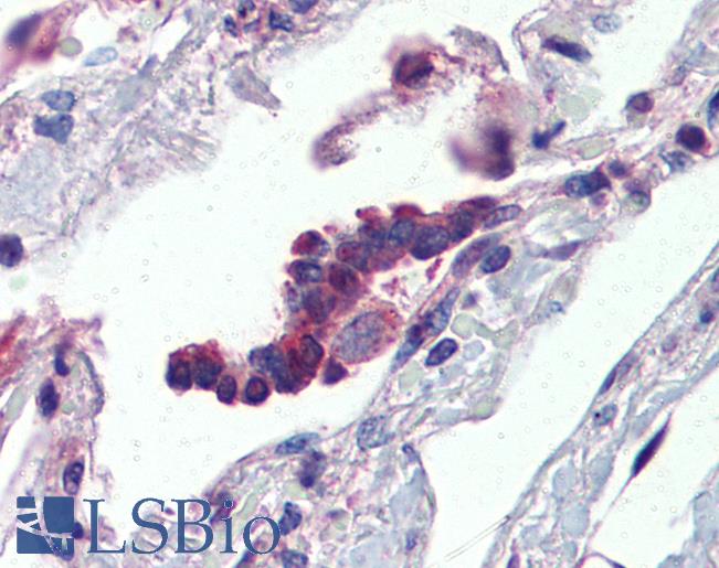 Anti-PLUNC antibody IHC of human lung, respiratory epithelium. Immunohistochemistry of formalin-fixed, paraffin-embedded tissue after heat-induced antigen retrieval. Antibody LS-B3549 concentration 5 ug/ml.