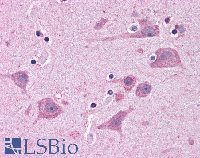 Anti-TNKS1BP1 antibody IHC of human brain, cortex. Immunohistochemistry of formalin-fixed, paraffin-embedded tissue after heat-induced antigen retrieval. Antibody LS-B4442 concentration 5 ug/ml.