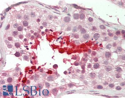 Human Testis: Formalin-Fixed, Paraffin-Embedded (FFPE)