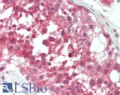 Human Testis: Formalin-Fixed, Paraffin-Embedded (FFPE)