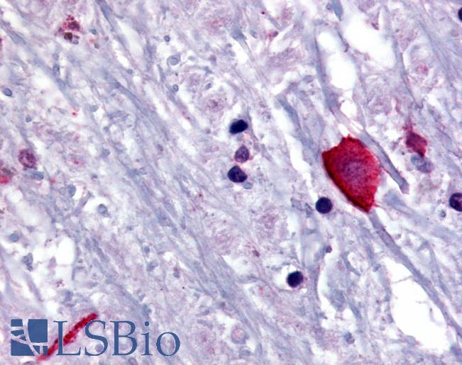 Anti-BRS3 antibody LS-A2287 IHC of human brain, thalamus. Immunohistochemistry of formalin-fixed, paraffin-embedded tissue after heat-induced antigen retrieval.