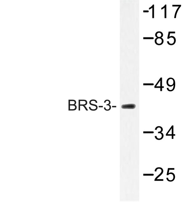 Western blot of BRS-3 (C203) pAb in extracts from HUVEC cells.