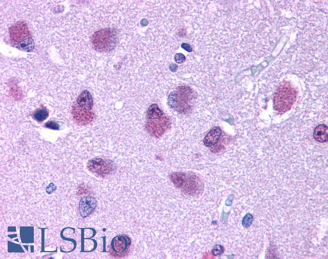 Anti-BRS3 antibody LS-A23 IHC of human brain. Immunohistochemistry of formalin-fixed, paraffin-embedded tissue after heat-induced antigen retrieval.