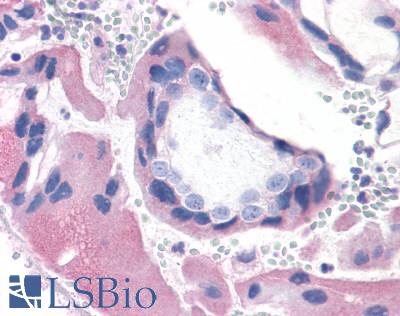 Anti-BRS3 antibody LS-A5055 IHC of human placenta, villi. Immunohistochemistry of formalin-fixed, paraffin-embedded tissue after heat-induced antigen retrieval.