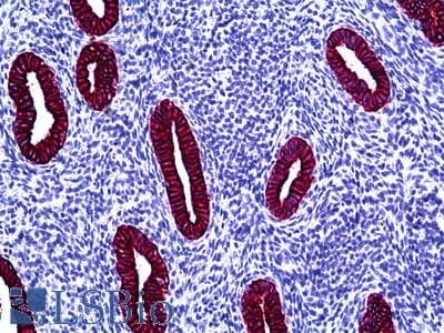 Anti-Cytokeratin Type II antibody IHC of human uterus. Immunohistochemistry of formalin-fixed, paraffin-embedded tissue after heat-induced antigen retrieval. Antibody LS-B5557 dilution 1:100.