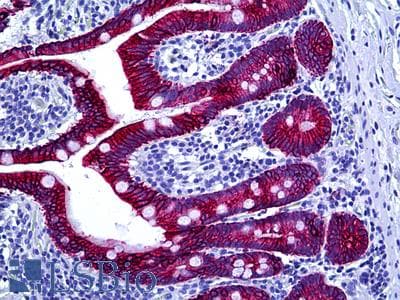 Anti-Cytokeratin Type II antibody IHC of human intestine. Immunohistochemistry of formalin-fixed, paraffin-embedded tissue after heat-induced antigen retrieval. Antibody LS-B5557 dilution 1:100.