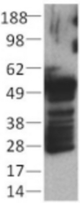 MCF7 cell lysates prepared under reducing conditions were resolved by SDS-PAGE then immunoblotted with 2 ug/ml of anti-basic Cytokeratin (AE3) antibody. Bands were visualized using HRP-conjugated anti-mouse IgG.