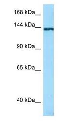 TNN antibody Western Blot of RPMI-8226.