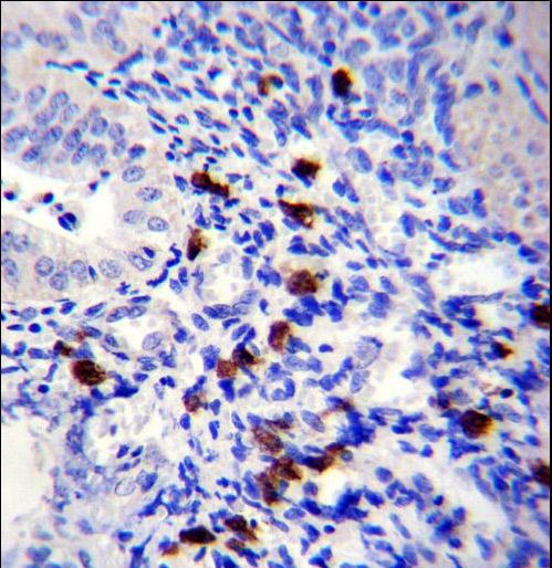 TNN Antibody immunohistochemistry of formalin-fixed and paraffin-embedded human uterus tissue followed by peroxidase-conjugated secondary antibody and DAB staining.