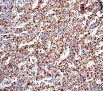 IHC of paraffin-embedded human spleen tissue using anti-Complement C1q antibody (LS-C105528).