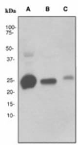 Western blot analysis on (A) human plasma, (B) human spleen and (C) fetal marrow lysates using anti-C1q (subunit C) antibody (LS-C105528), dilution 1:5000.
