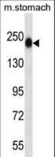 TNN Antibody western blot of mouse stomach tissue lysates (35 ug/lane). The TNN antibody detected the TNN protein (arrow).