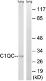 Western blot of extracts from rat lung cells, using C1QC Antibody. The lane on the right is treated with the synthesized peptide.