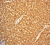 IHC of paraffin-embedded human liver tissue using anti-Complement C1q (subunit A) antibody (LS-C105453).