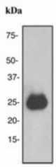 Western blot analysis on human plasma lysate using anti-C1q (subunit A) antibody (LS-C105453), dilution 1:1000.