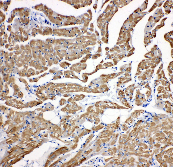 TNNC1 / Cardiac Troponin C antibody. IHC(P): Rat Cardiac Muscle Tissue.