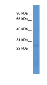 C1QL1 / CRF antibody LS-C135271 Western blot of Mouse Spleen lysate.