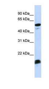 C4BPA antibody Western blot of MCF7 cell lysate.