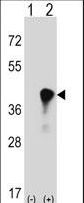Western blot of C4BPB (arrow) using rabbit polyclonal C4BPB Antibody. 293 cell lysates (2 ug/lane) either nontransfected (Lane 1) or transiently transfected (Lane 2) with the C4BPB gene.