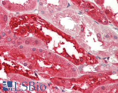 Human Kidney: Formalin-Fixed, Paraffin-Embedded (FFPE)