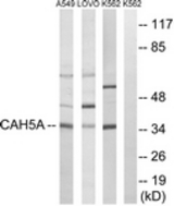 Western blot of extracts from A549/LOVO/K562 cells, using CA5A Antibody. The lane on the right is treated with the synthesized peptide.