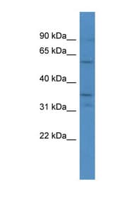 CA5A antibody LS-C135710 Western blot of MCF7 cell lysate.