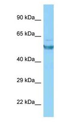 CAMK2G / CAMK antibody Western Blot of THP-1.