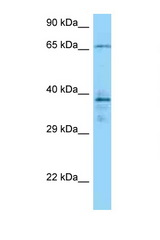 CAMK2G antibody LS-C146234 Western blot of 1 Cell lysate. Antibody concentration 1 ug/ml.