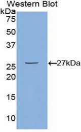 Western blot of recombinant CAMK2G / CAMK.