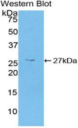 Western blot of recombinant CAMK2G / CAMK.