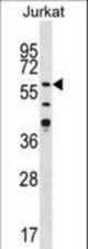Western blot of anti-CAMK2 delta-like Antibody in Jurkat cell line lysates (35 ug/lane). CAMK2G (arrow) was detected using the purified antibody.