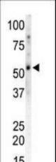 The anti-CAMK2 gamma C-term antibody is used in Western blot to detect CAMK2 gamma in mouse heart tissue lysate.