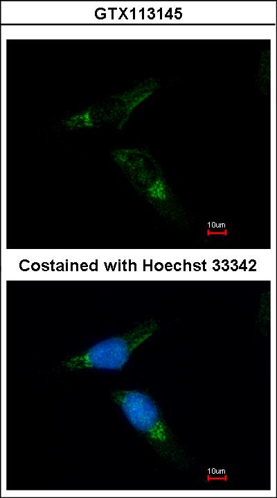 Immunofluorescence of methanol-fixed HeLa, using CaMKII gamma antibody at 1:500 dilution.