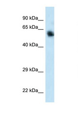 CAMKK1 / CaMKK antibody LS-C145453 Western blot of 293T Cell lysate. Antibody concentration 1 ug/ml.
