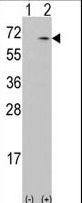 Western blot of CAMKK1 (arrow) using rabbit polyclonal CAMKK1 Antibody. 293 cell lysates (2 ug/lane) either nontransfected (Lane 1) or transiently transfected with the CAMKK1 gene (Lane 2).