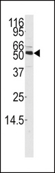 Western blot of anti-CAMKK1 Antibody in mouse thymus tissue lysates (35 ug/lane). CAMKK1 (arrow) was detected using the purified antibody.