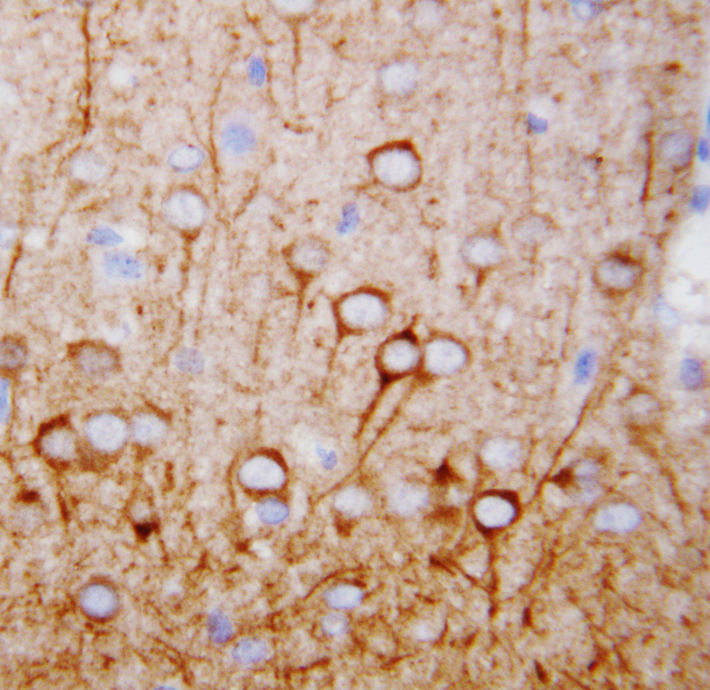 CAMKK1 / CaMKK antibody. IHC(P): Rat Brain Tissue.