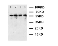 WB of CAMKK1 / CaMKK antibody. Lane 1: Rat Brain Tissue Lysate. Lane 2: Rat Brain Tissue Lysate. Lane 3: Mouse Brain Tissue Lysate. Lane 4: Mouse Brain Tissue Lysate.