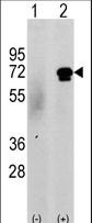 Western blot of CAMKK2 (arrow) using rabbit polyclonal CAMKK2 Antibody (N-term G67). 293 cell lysates (2 ug/lane) either nontransfected (c) or transiently transfected with the CAMKK2 gene (Lane 2) (Origene Technologies).