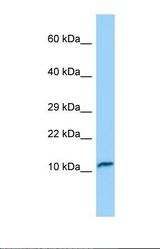 Western blot of Human RPMI-8226. TNNC2 antibody dilution 1.0 ug/ml.