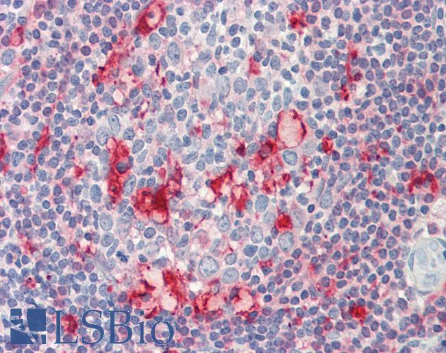 Anti-CAPG / MCP antibody IHC staining of human tonsil. Immunohistochemistry of formalin-fixed, paraffin-embedded tissue after heat-induced antigen retrieval.